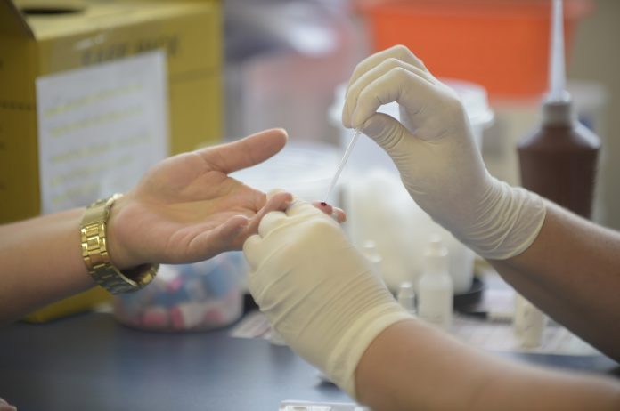 Teste rápido dsts HIV Sífilis e Hepatites_Foto Fábio Nunes Teixeira 014